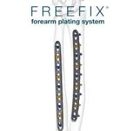 FREEFIX® Forearm Plating System - The next generation of locking plate  design with indication specific options for the radius and ulna.,  https://skeletaldynamics.com/products/freefix-forearm-plating-s...