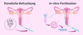 Wann die einnistungsblutung frühestens stattfindet, wie stark & lang sie sein kann und welche farbe die blutung hat, liest du einnistungsblutung: Unterschiede Zwischen Insemination Und In Vitro Fertilisation Ivf