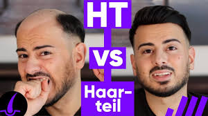 Hier finden sie informationen zu kommunalpolitik und dienstleistungen. Transformation Volle Haare Ohne Haartransplantation Haarausfall By Jacob M