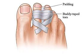 Pin On Toe Sprain