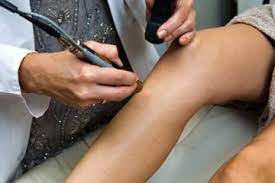 The average person needs 7 to 10 sessions, and packages are typically sold in 6 or 9. How Much Does Laser Hair Removal Cost Howstuffworks