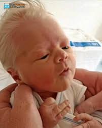 He was mocked online for his looks... they said "he's born old", "and looks  like a grandpa." But wait till you see what he looks like now. Photos 👇