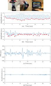 atrial fibrillation detection from wrist