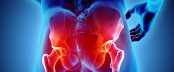 L'ostéoporose est la maladie des os la plus courante. Arthrose De L Articulation Sacro Iliaque Causes Symptomes Traitement Et Chirurgie