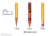 Figure, Millimeters (mm). A sharp pencil...] - PDQ Cancer ...