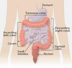 It is caused by uncontrolled cell growth, and affects a wide range of cell types and organs in the body. Colorectal Cancer Physiopedia