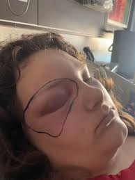 Support for Local Family with Daughter in Hospital in Salt Lake City