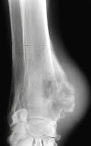 And, depending on the tumour, it can spread to other parts. Skeletal Abnormality In Dogs And Cats