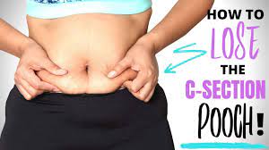 How To Lose The C-Section Pooch - Italianpolishmomma.com