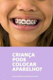 Quando Uma Crianca Pode Colocar Aparelho Entenda Vamos Mamaes Colocar Aparelho Aparelho Dentario Aparelho