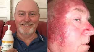 Girl, 5, diagnosed with leukaemia