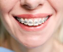5 Ways Orthodontic Treatment Can Improve Your Confidence and Health