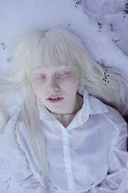 Pin By Rosario On White Haired Albino Girl Pale Beauty Dark Beauty