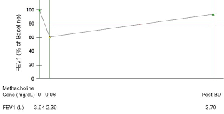 Image result for Inhalation Challenge Test