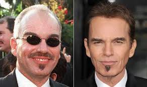 Celebrity hair loss, a pinterest board pinned by dr. Celebrity Hair Transplants Are On The Rise