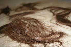 Kittens exhibit reddish areas on the face, ears, and paw pads, sometimes accompanied by a white or gray crust. Are You Losing Your Hair 5 Key Signs That You Shouldn T Ignore Gofybr Hair Building Fibers