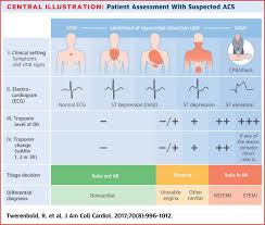 image result for lead chart for myocardial infarction