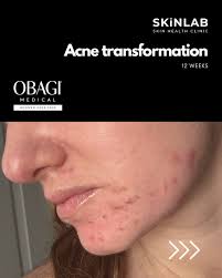 Skinlab Michael Perks