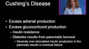 Cushing S Syndrome Physiopedia