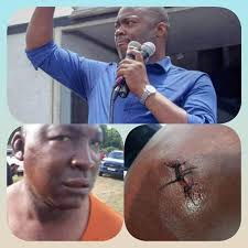 JAMAICANS! WHERE ON NOMINATION DAY, MONDAY AUGUST 18,2025 HAVE ANYONE SAW  JLP ATTACKING PAINPISS ( PNP) MOTOR CADE???... THIS IS ALMOST SIMILAR TO DR  DRAWS IN WATERFORD WITH HIS GOONS BLOCKING THE