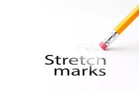 It is one of the best home remedies to get rid of stretch marks. 4 Treatments That Will Help You Get Rid Of Stretch Marks