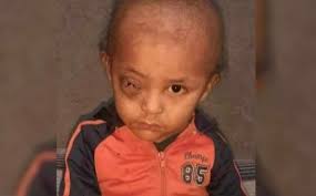 Piden apoyo para José Manuel, niño con cáncer San Felipe, Guanajuato|  Telediario México