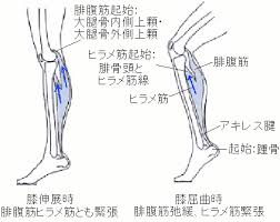 検索するカテゴリーを選択します。 すべてのカテゴリー audible・オーディオブック amazon デバイス kindleストア prime video alexaスキル デジタルミュージック android アプリ 本 洋書 ミュージック クラシック dvd tvゲーム pcソ. è¶³åº•ç­‹è†œç‚Ž ãƒ¢ãƒ¼ãƒˆãƒ³ç—… ã‚·ãƒ³ã‚¹ãƒ—ãƒªãƒ³ãƒˆå¾Œå†…å´åž‹ã®é¼ç¸æ²»ç™‚ã®å…±é€šç‚¹ ç¾ä»£åŒ»å­¦çš„é¼ç¸æ²»ç™‚