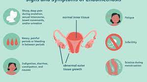 11 Natural Treatments For Endometriosis