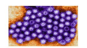 It passes easily through direct or indirect contact with an infected person. Norovirus National Collaborating Centre For Infectious Diseases