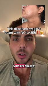 Actual Bella Beard Be Gone Reviews