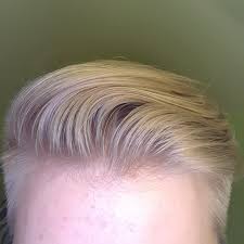 In a place so obvious as the front can be very frustrating. A Few Weeks Back I Noticed That The Hair In The Front Of My Head Appears Very Thin To The Point Where Yo Balding Mens Hairstyles Hairline Celebrity Hair Colors