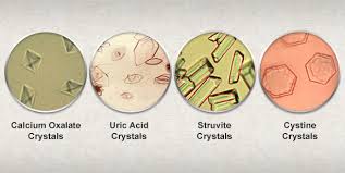 Urinary Crystals Urinary Crystals Crystalluria Pet