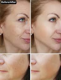 This is where the dermawand comes in. 8 Best High Frequency Facial Massagers For Flawless Skin 2021