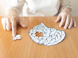 At the time of assessment, a group of patients with dementia were sat in a. Luye Signs Over Japan Rights For Dementia Patch To Towa Pharmaceutical 2021 03 02 Bioworld