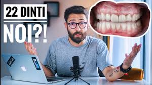 Nu uitati ca au mai ramas doar 2 zile pana alegem castigatorul norocos care va pleca acasa cu cel mai tare bmw maxitunat ‼️ daca te. I Am Pus 22 Dinti Noi Naturali Iti Dai Seama Care Youtube