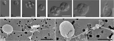 See more of loker pt. Insights Into The Origin Of Metazoan Multicellularity From Predatory Unicellular Relatives Of Animals Bmc Biology Full Text