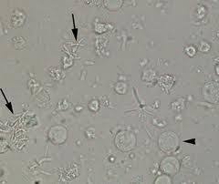 Bacteria In Urine Medical Laboratory Scientist Medical Laboratory Science Medical Laboratory