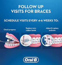 However, many still fear check the opening hours. Braces Your Final Appointment Oral B