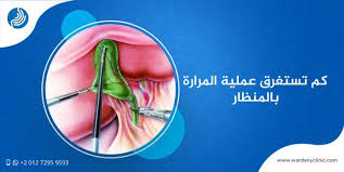 كم تستغرق عملية المرارة بالمنظار وما هي النصائح الواجب اتباعها قبل الجراحة