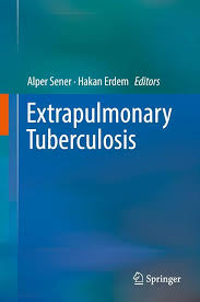 Image result for Extrapulmonary Tuberculosis