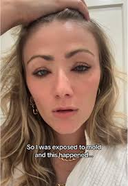 Renee Ebersole Mold Exposure