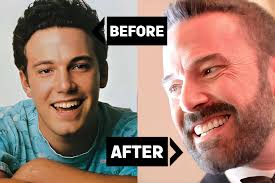 How Cosmetic Dentistry Refined Ben Affleck's Iconic Smile