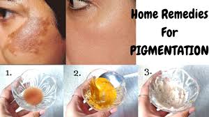 Lets take a look at what can cause it and the treatments available. Home Remedies To Get Rid Of Pigmentation In Just 10 Days Top 3 Natural Ways To Cure Pigmentation Youtube