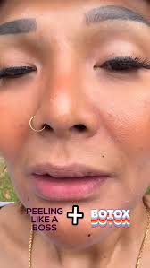 Thank you to Max clinic Singapore..., 16,Collyer Quay , #02-01 , Dm them  for consultation & Face Check for better tomorrow.., #sexyafter40  #touristguidesg #fyp #ilovemyjob