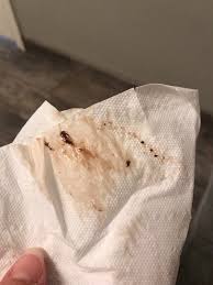 Maybe you would like to learn more about one of these? 3 Weeks Pregnant Brown Discharge When I Wipe Novocom Top