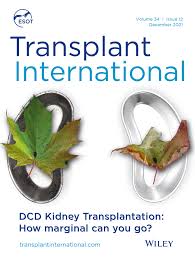 Image result for Transplantation