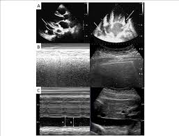 Advance your care with portable, adaptable ultrasound systems built to provide excellent image quality while keeping up with your active environment. Point Of Care Ultrasound Machine Toshiba Aplio Mx Ssa 780a Probe Download Scientific Diagram