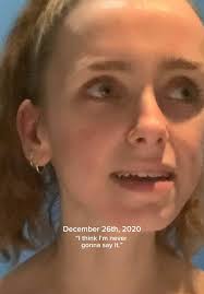 Ro Mitchell Recovery