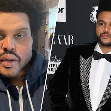 Check spelling or type a new query. Echt Oder Fake The Weeknd Schockt Fans Mit Neuem Gesicht Krone At