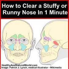 How To Clear A Stuffy Or Runny Nose In 1 Minute Home Health Runny Nose Health Remedies